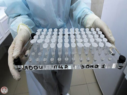 واکسن کرونا کی ساخته میشود؟ 2 corona-vaccine-world-virus